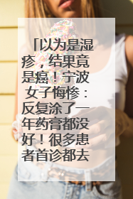 以为是湿疹，结果竟是癌！宁波女子悔惨：反复涂了一年药膏都没好！很多患者首诊都去了皮肤科